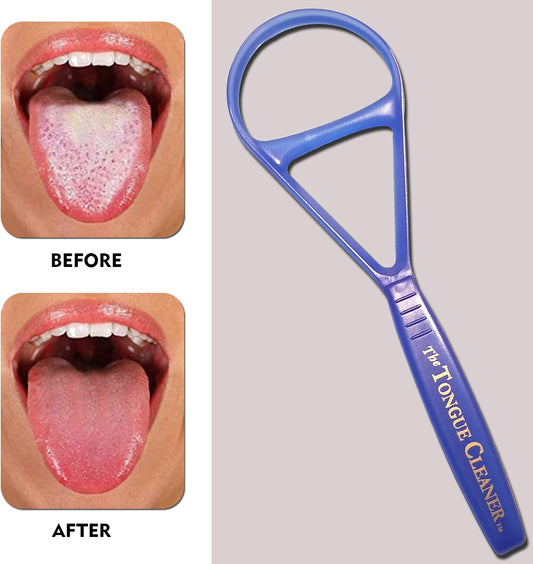The Tongue Cleaner